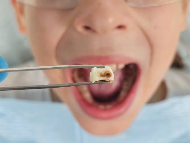 Best 24-Hour Emergency Dentist in Central Park, WA