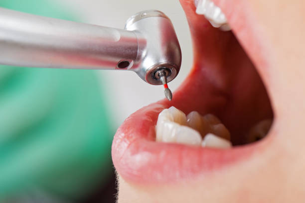 Best Emergency Dentist for Special Needs Patients in Central Park, WA